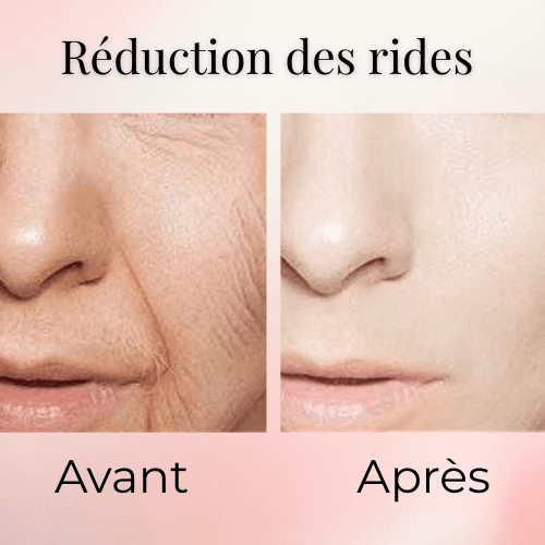 Masque de Nuit au Collagène | Hydratation & Fermeté Pendant le Sommeil